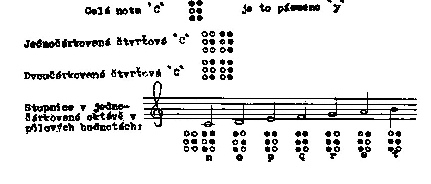 Brailleská hudební notace